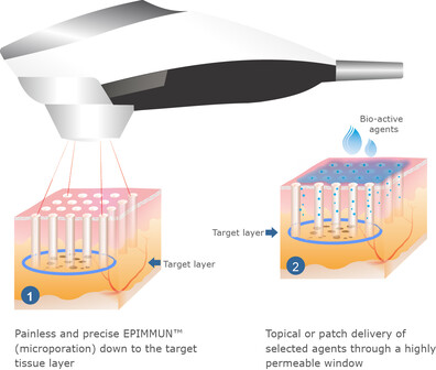 2 step procedure